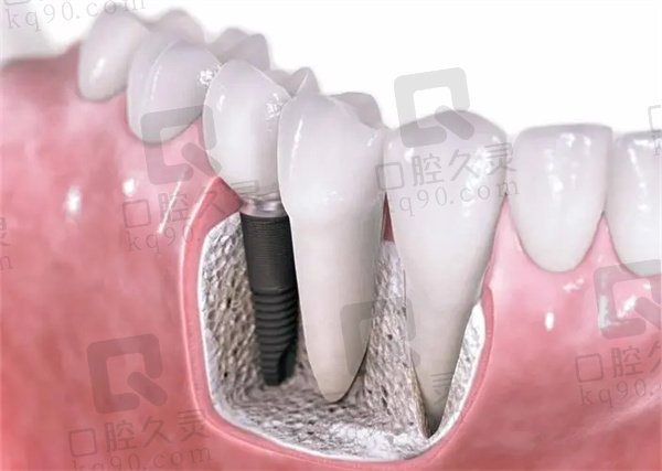 香港看牙齒哪家醫院好