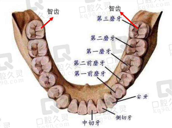 为什么医生不让我一次性把智齿都拔了？