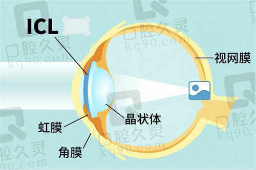 北京华德眼科医院