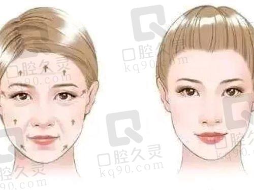 劉富增教丨授拉皮怎么樣 劉富增教丨授拉皮怎么樣