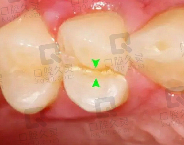 南京溧水张英博口腔医院怎么样