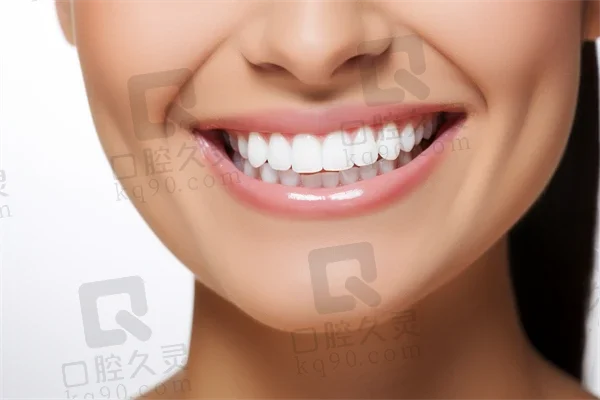 牙齿护理有诀窍，三步还你美白健康牙齿！