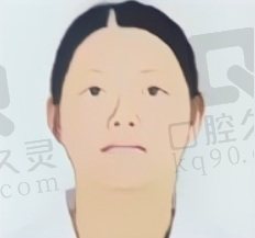 张玉琴