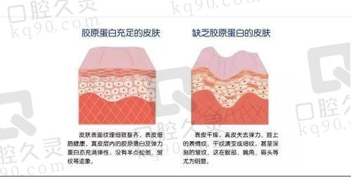 大连沙医生整形田艳丽做双眼皮技术优势
