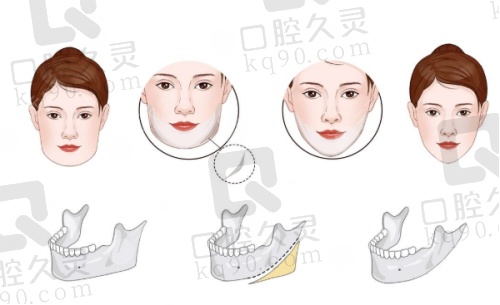如何正确找到北京画美医疗美容医院？