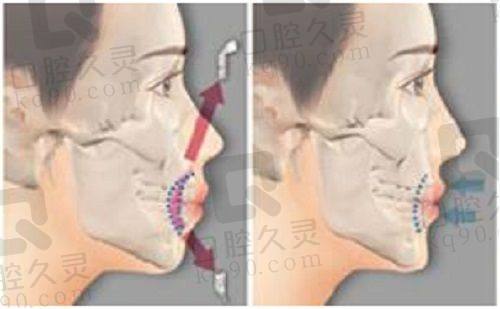 青岛壹美天成陈芙莉医生擅长项目怎么样？