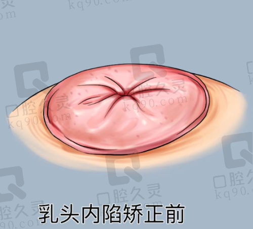 北京画美医院与国有医院相比有哪些优势和劣势？