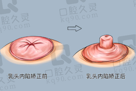 北京画美医疗美容医院地址对其品牌形象有何作用？