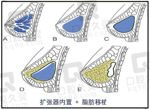 总结