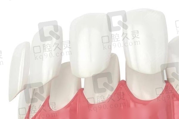 漳州中诺口腔国产全瓷牙贴面999元起，优质材料与先进技术打造牙齿美容新体验