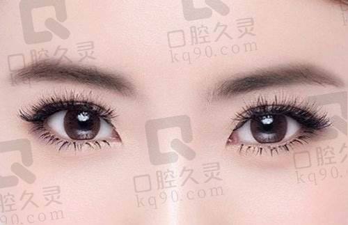 四、曾繁茂双眼皮手术的“零失败”密码