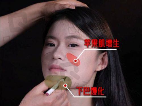 郑州管城中医院治疗小孩耳朵畸形成效好吗？