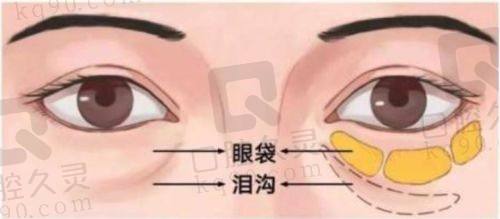 术前准备，为美丽蜕变做足功课！