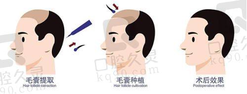大连爱德丽格刘院长收费贵吗？