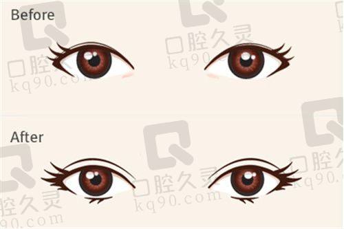西安市中 心医院烧伤整形科的整形价格