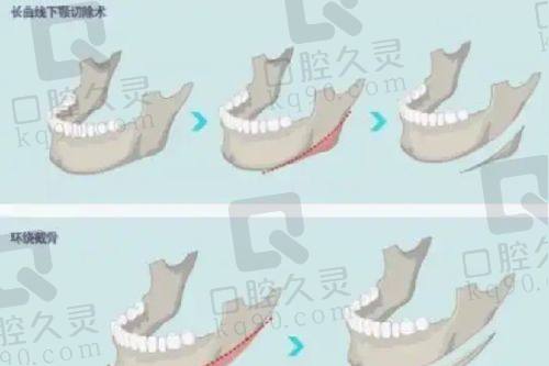常州新海派苏广美医生怎么样？