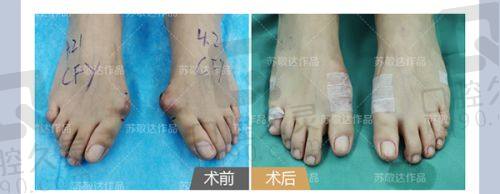 北京蒂凡妮疗整形美容医院怎么样？技术精湛、服务贴心，打造个性化美丽方案 