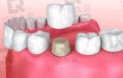 价格透明：让看牙不再
