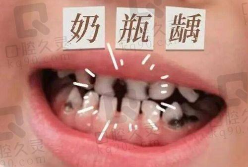二、价格暴击：种牙省下一辆电动车，洗牙不如奶茶贵