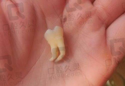 东莞博球口腔医院能用医保吗？能用医保，部分项目报销超省心！ 