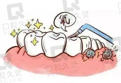 三、汕头牙博士口腔医院口碑如何？不妨来看集美们的实例评价