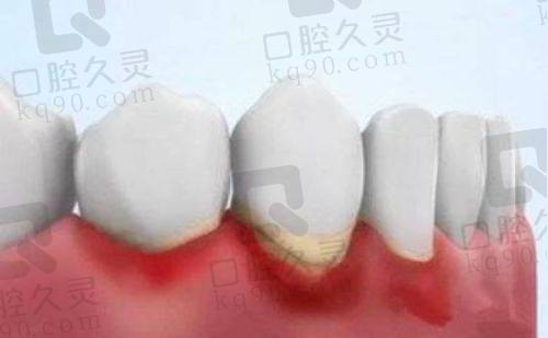 深圳非凡口腔医院是公立的吗？正规私立口腔，技术优口碑好值得选！ 