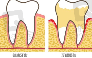 正畸过程全解析：从询问到保持