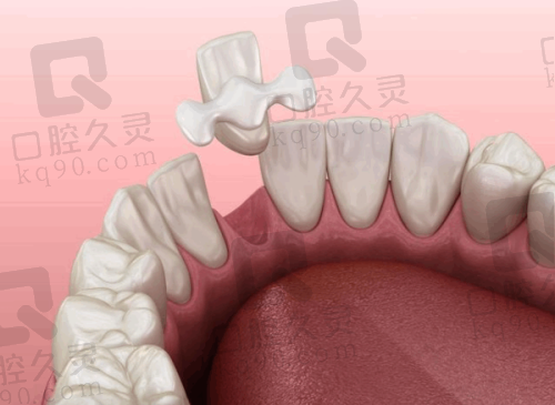 总结：让牙齿问题不再是负担