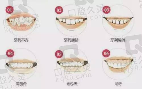 东莞博球口腔医院医疗保险使用优势
