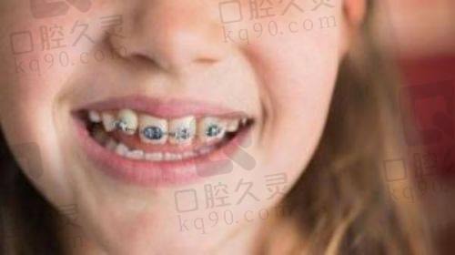 北京劲松口腔苏州桥分院口碑评价如何？专业医生团队与优质设备助力口腔健康保障！