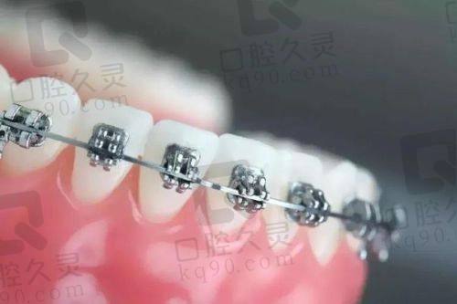 四、南昌摩尔口腔医院是几级医院——特色项目优势凸显