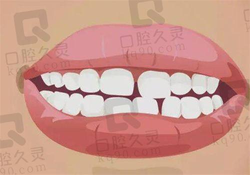 牙套类型选择多：隐形矫正/舌侧矫正/托槽矫正都有