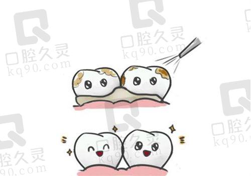济宁董甜甜口腔诊所患者反馈