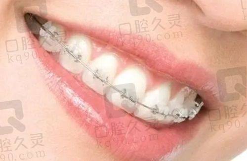 深圳非凡口腔医院的服务保护