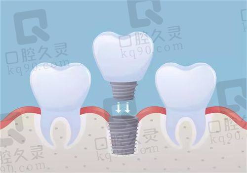 永州中南口腔口碑好，好评来源于患者真实体验