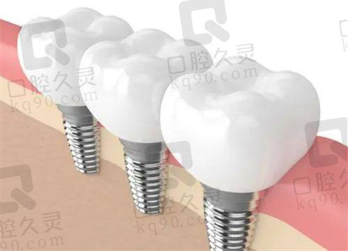关于选择口腔医院的一些建议