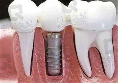 治疗报销比例详解：能省一笔是一笔