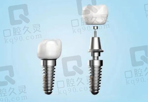 专精团队：为您的笑容保驾护航