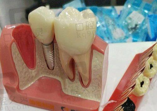 永州中南口腔医院医生团队经验多，种牙矫正技术实力强