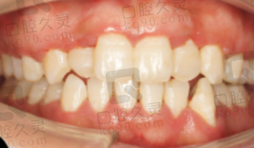 唐山中牙口腔是莆田系吗？不是莆田而是资质正规实力强劲的连锁品牌