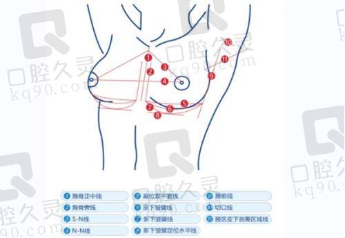 北京联合丽格第1医疗美容医院筋膜提升成效如何？