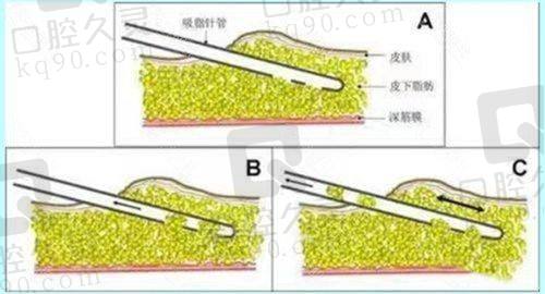潘贰眼博士修复技术的实际成效如何？