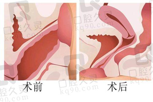 碧莲盛植发