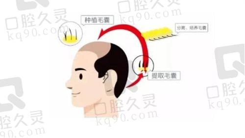 成都锦江大麦微针植发医疗美容门诊部预约方式