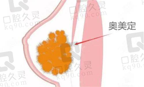 合肥维多利亚整形医院何贤清医生介绍值得关注吗？