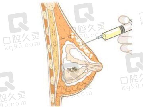广州治疗疤痕疙瘩的温馨小贴士