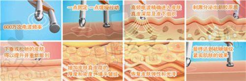 常州新海派苏广美医生患者评价