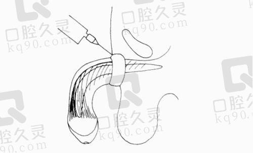 不同医院技术特点及适合人群总结