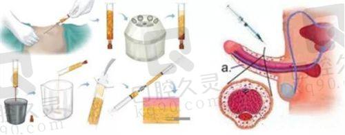 合肥维多利亚整形医院卫爱侠医生介绍如何？