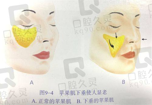 何明达医生面部除皱多少钱？大连爱德丽格价格透明，术后签约年轻 5 岁+！ 
